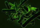 如何预防结核杆菌传染？